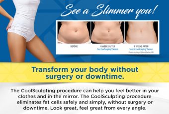 Introducing CoolSculpting