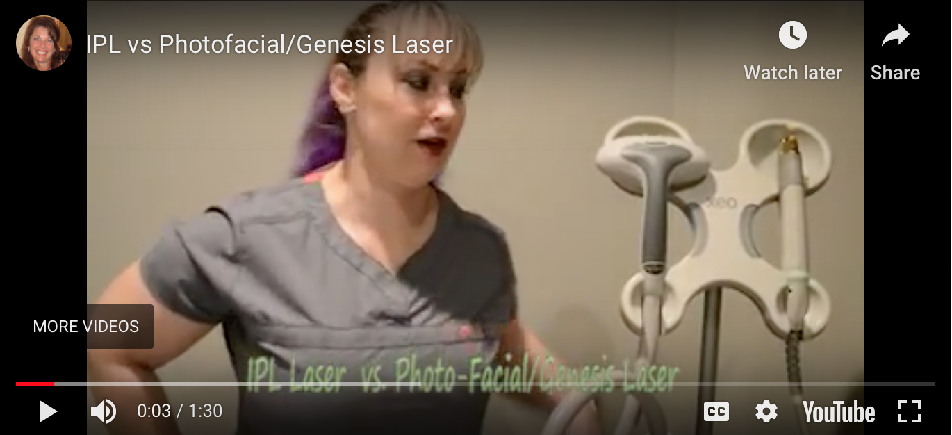 IPL vs Photofacial/Genesis Laser Youthtopia Med Spa Alpharetta GA