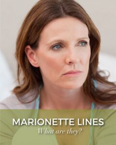 Brunette woman with a green boarder with white text that says what are marionettlines