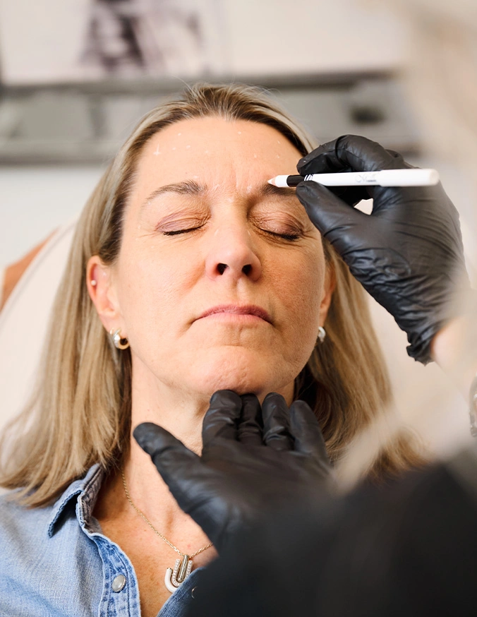 Woman receiving facial cosmetic treatment from practitioner wearing black gloves holding syringe near forehead - PDGF in Alpharetta, GA